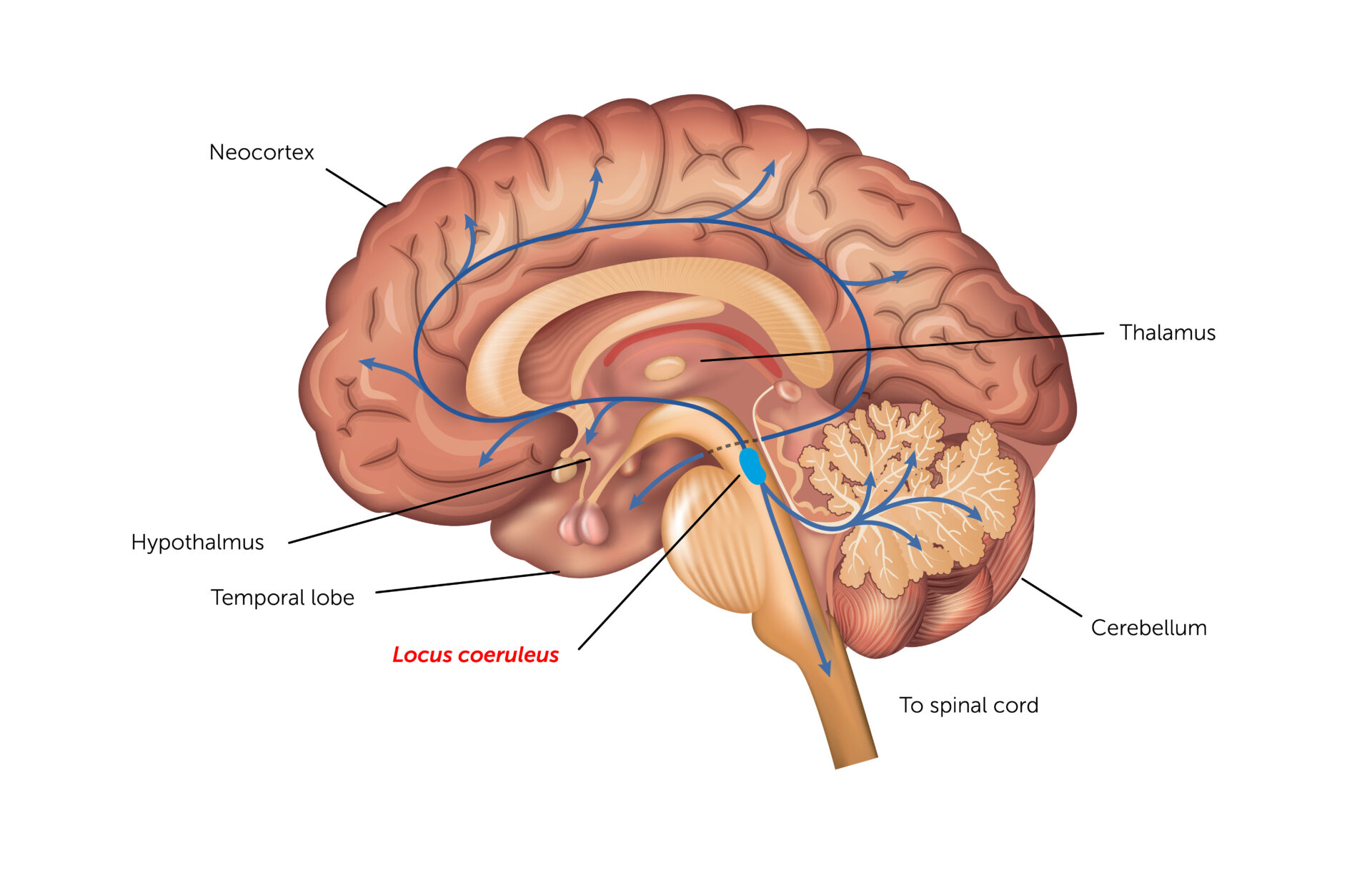 Study Links Alzheimers Onset To Sleep Disruption And Degeneration Of