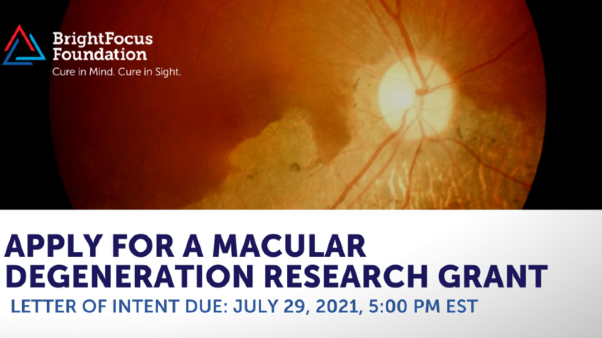 A retina and text inviting researchers to apply for a macular degeneration research grant.