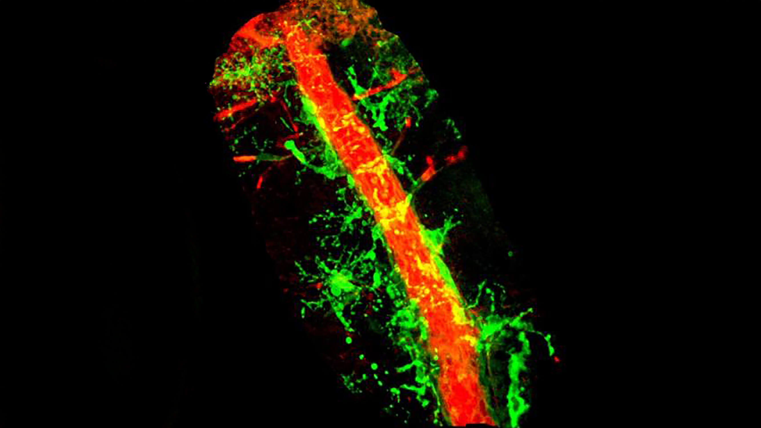 Immune cells interacting with blood vessels.