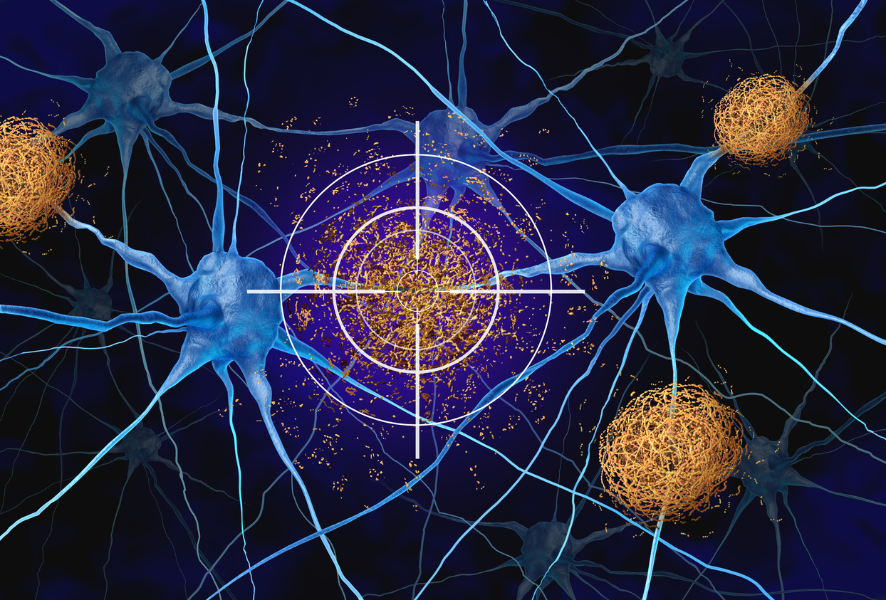 A digital rendering of two brain cells surrounded by amyloid plaques. One of the plaques has a bullseye over it. 