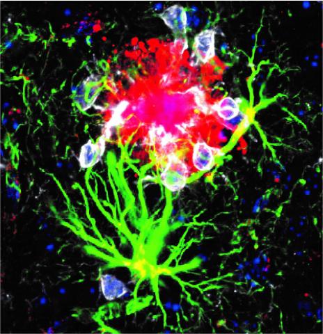 Microglia (white) and another cell responsible for brain health, called astrocytes (green), are expressing human APOE (red) in an Alzheimer’s animal model. Image provided by Butovsky laboratory.