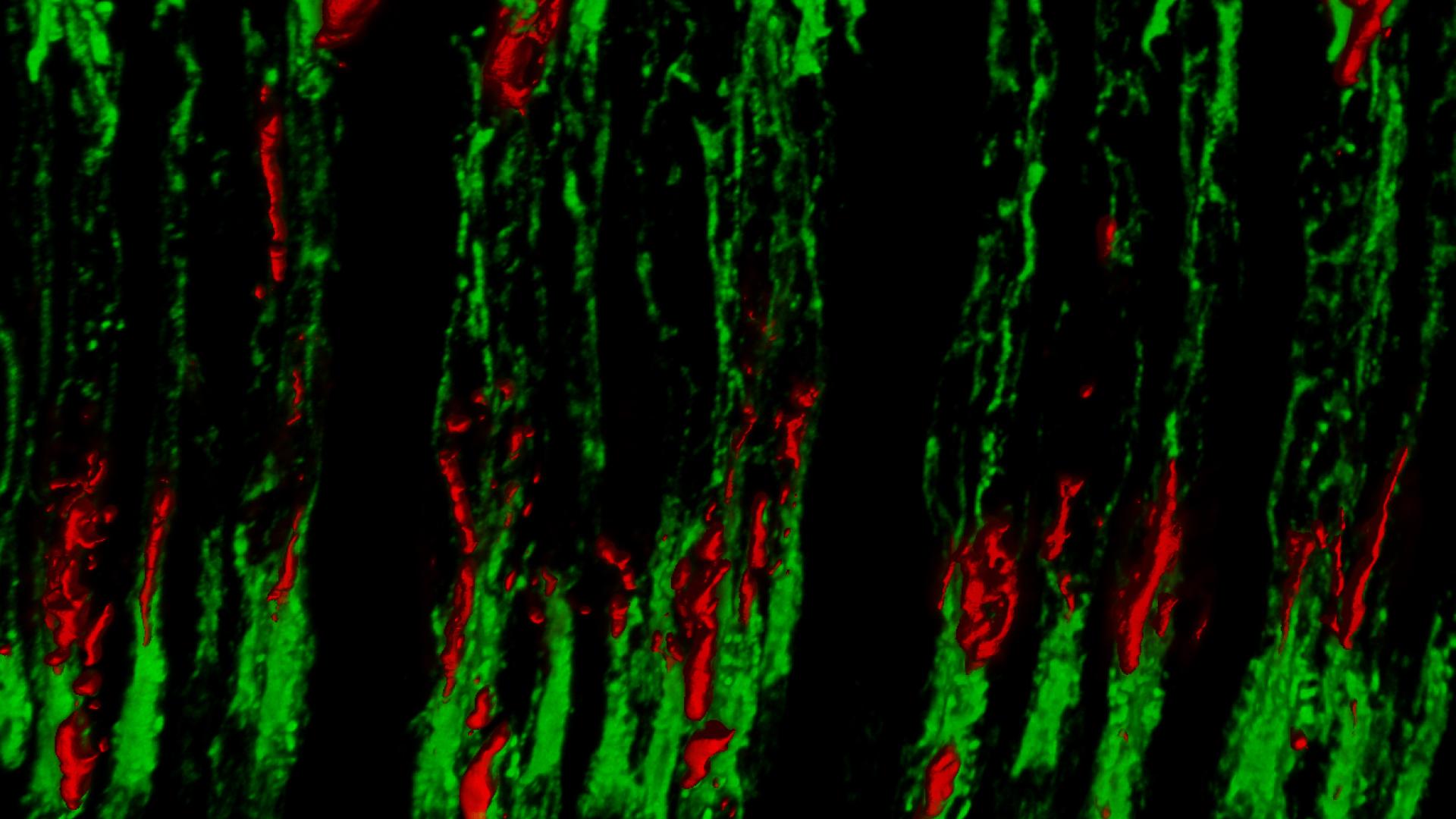 Microscopic view of rod and cone cells that are the light-sensitive photoreceptors of the eye.