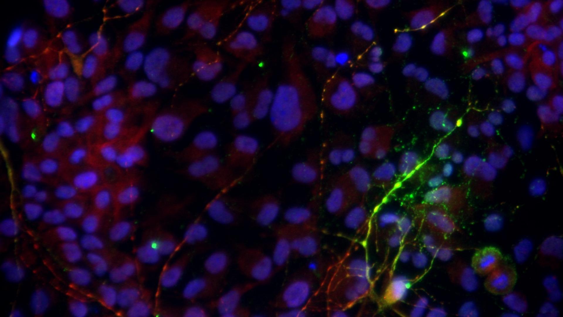 Neurons (shown in red) are differentiated from induced pluripotent stem cells carrying a genetic mutation that increases tau accumulation (shown in green).