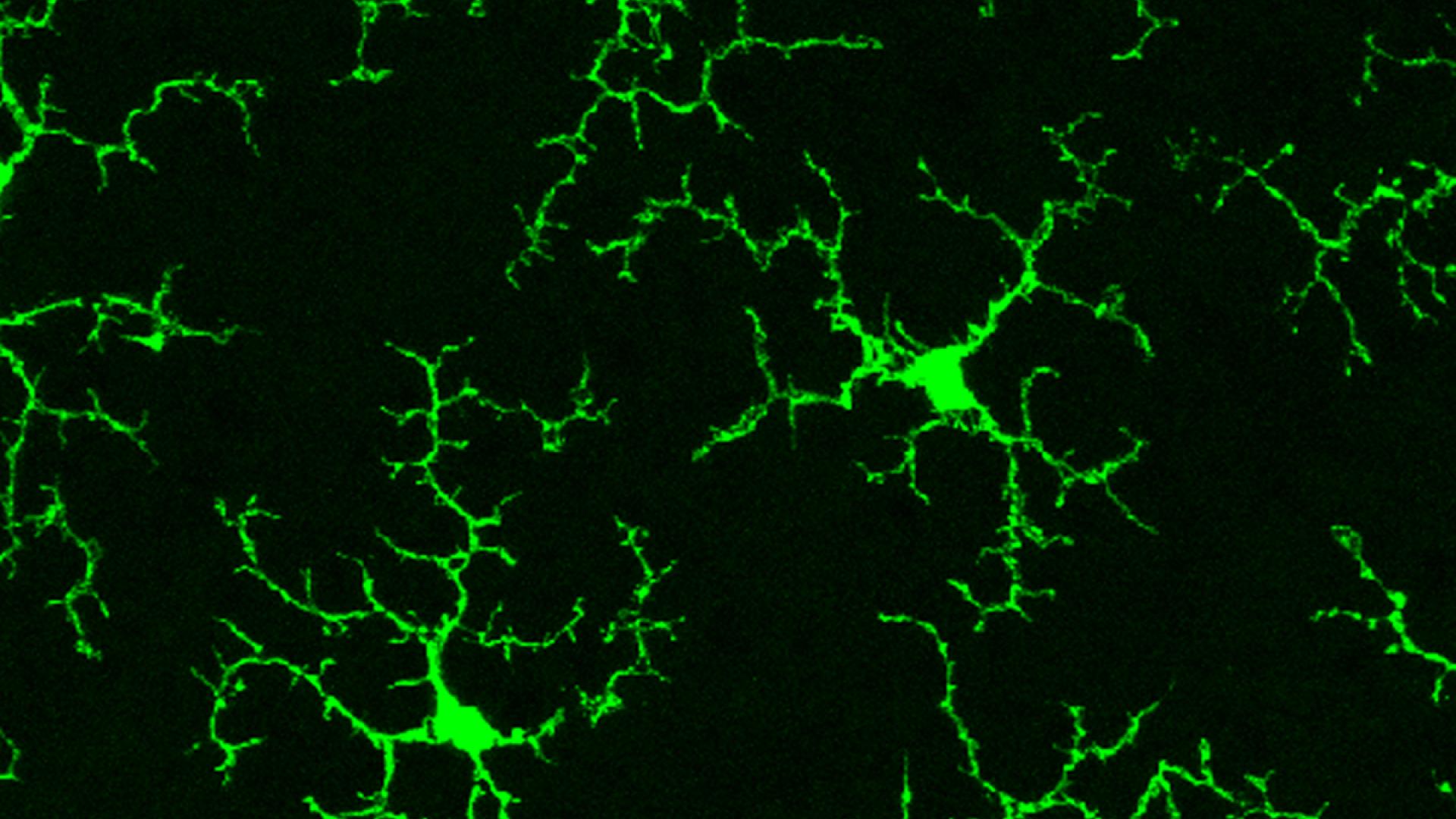 Magnified microglia (green branch-like structures) in a healthy adult mouse retina.