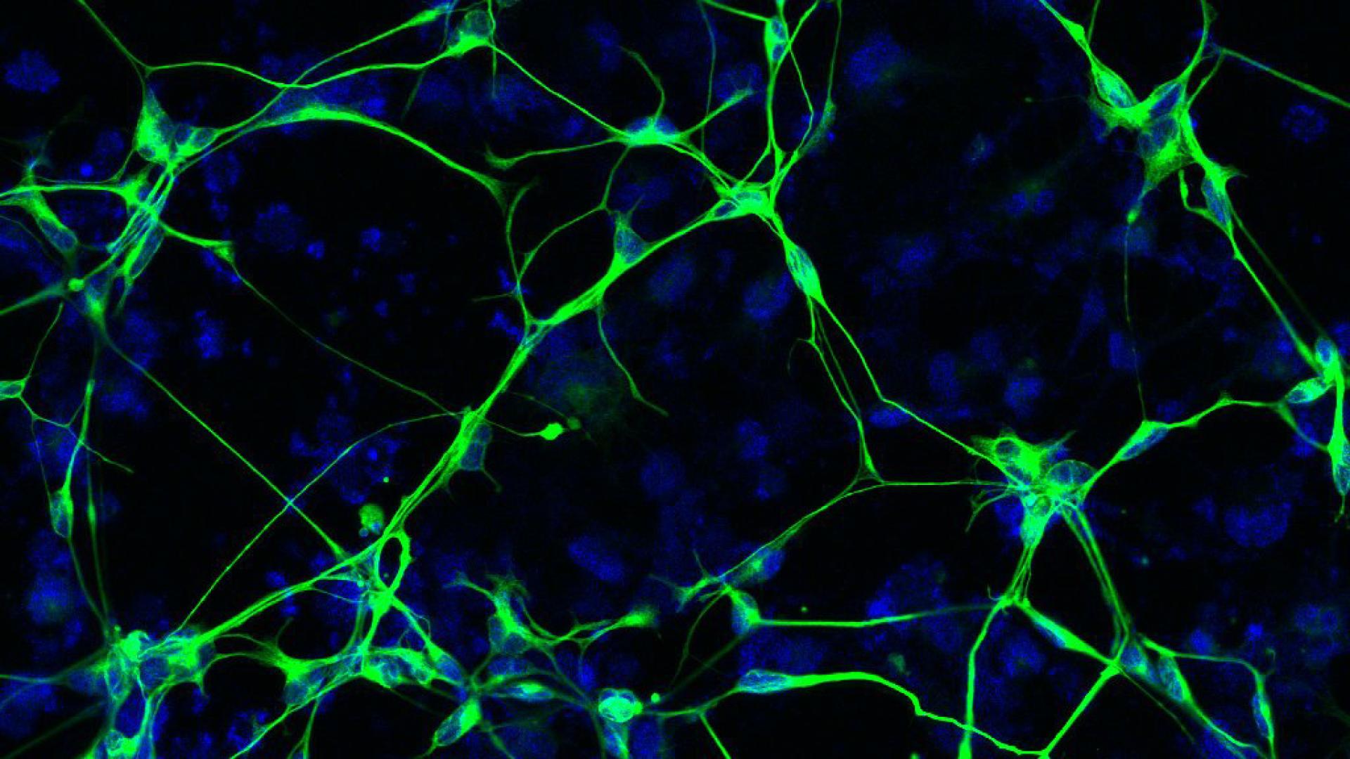 Neurons (green) derived from a patient with Alzheimer’s disease. The nuclei (blue) of the neurons are also shown.