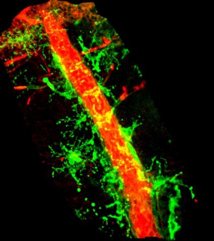 Immune cells interacting with blood vessels.