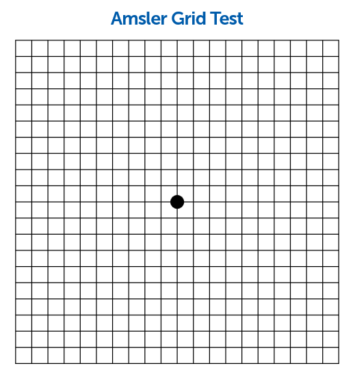 amsler image for insight