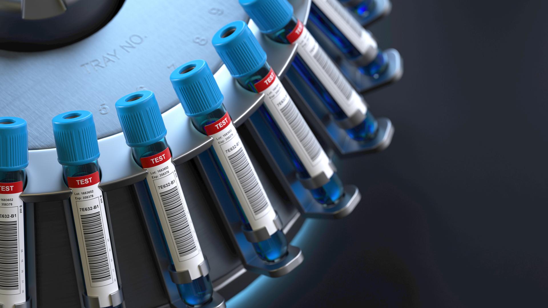 Vials of blood on a centrifuge for blood testing.