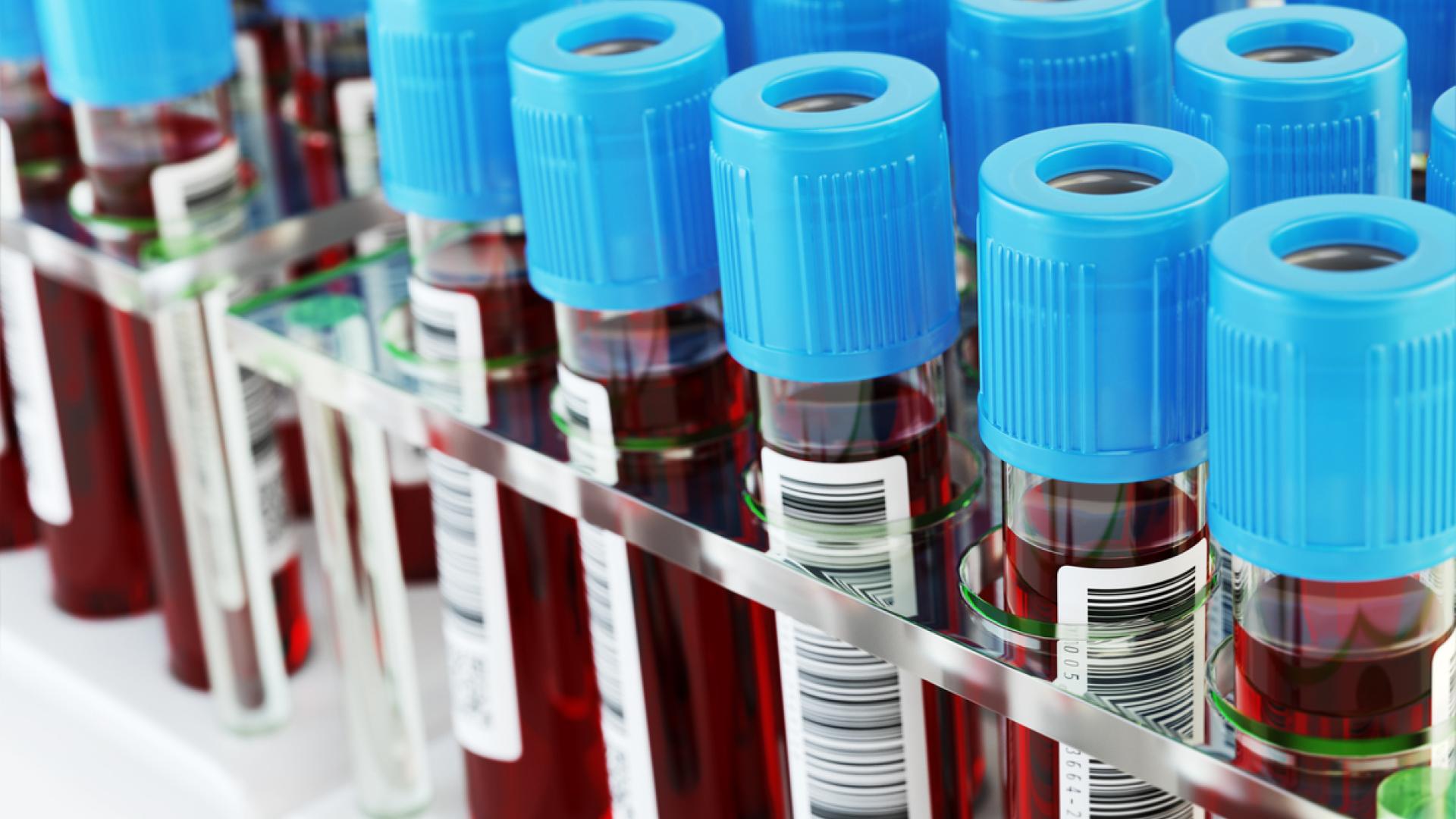 Test tubes with blood samples.