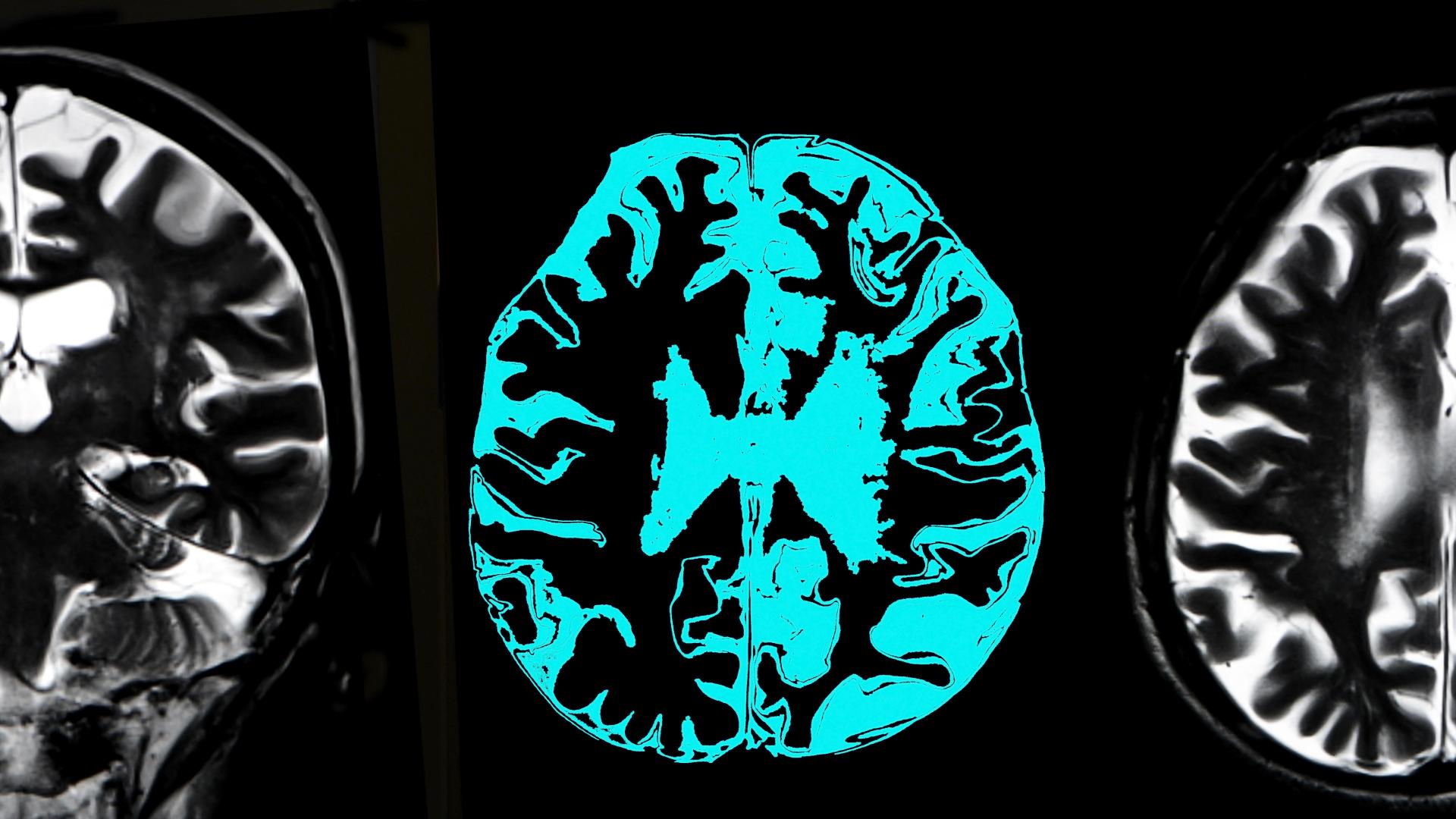 Illustration showing brain scans.