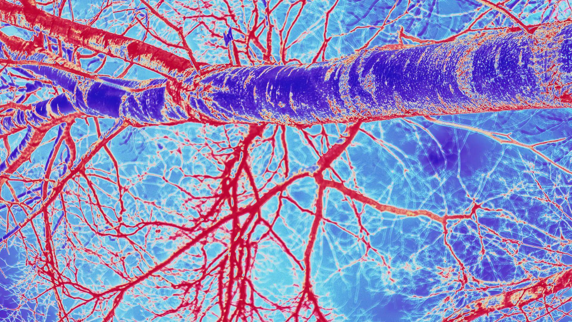 Medical illustration of blood vessels and capillaries.