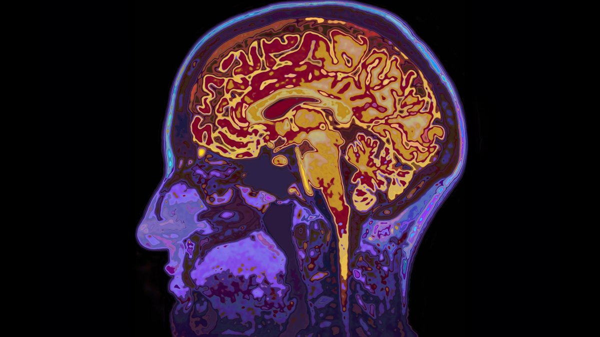 A colorful, cross-sectional brain scan showing detailed layers and structures of the brain in vibrant hues, against a black background.