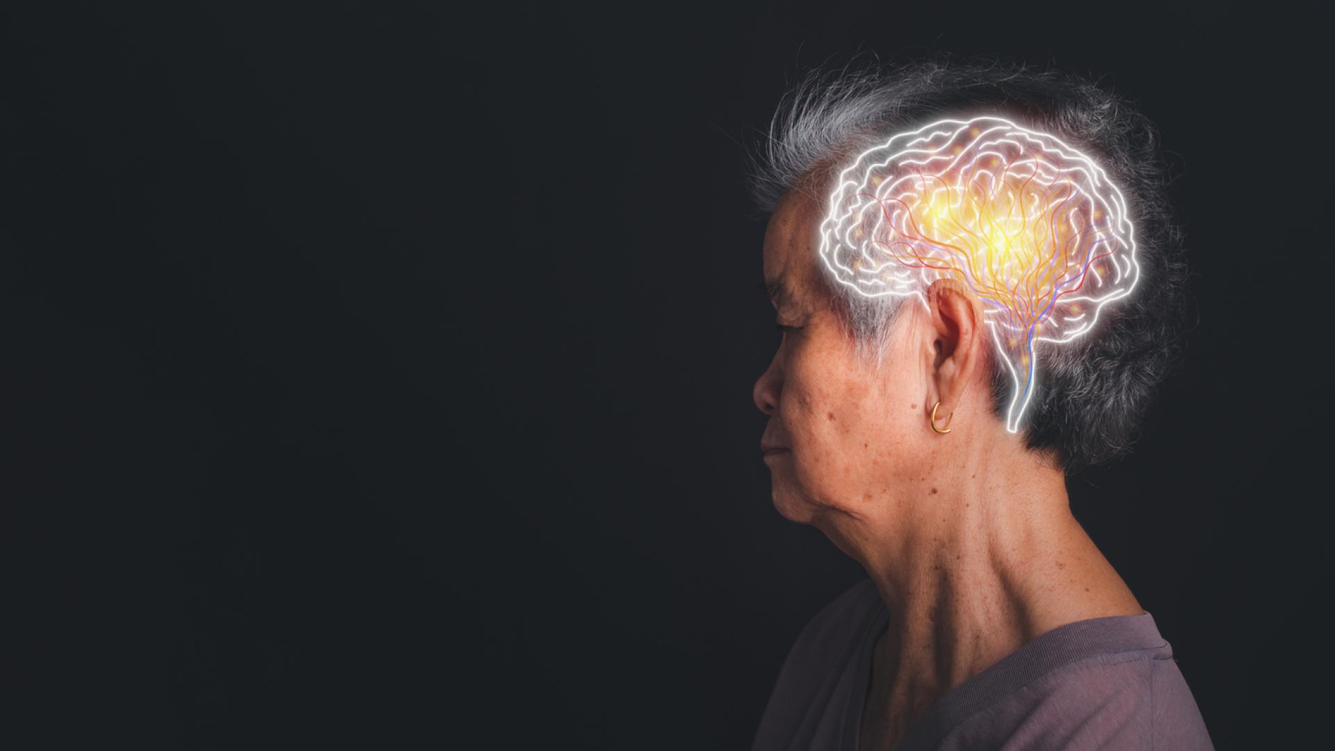 The side profile of a woman, looking away from the camera, against a dark background. There is an illustration of a brain overlayed on the photograph where her brain is.