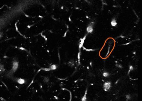 Outlined blood vessel in Stall Catchers.