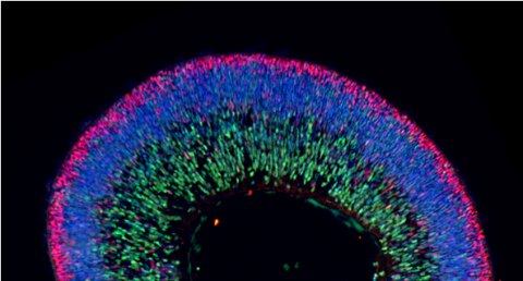 A retina in a dish model.