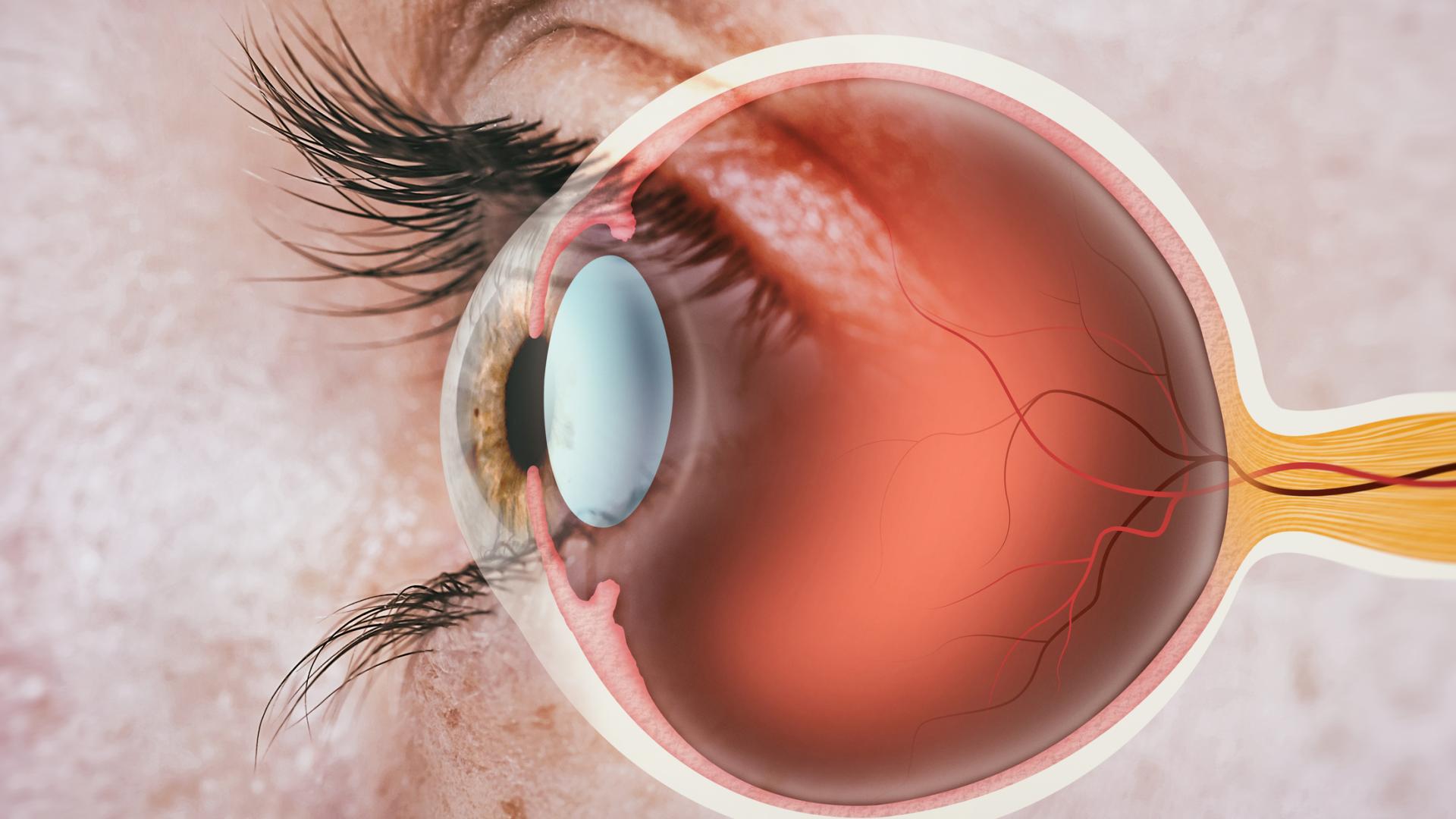 Cross section of the eye.