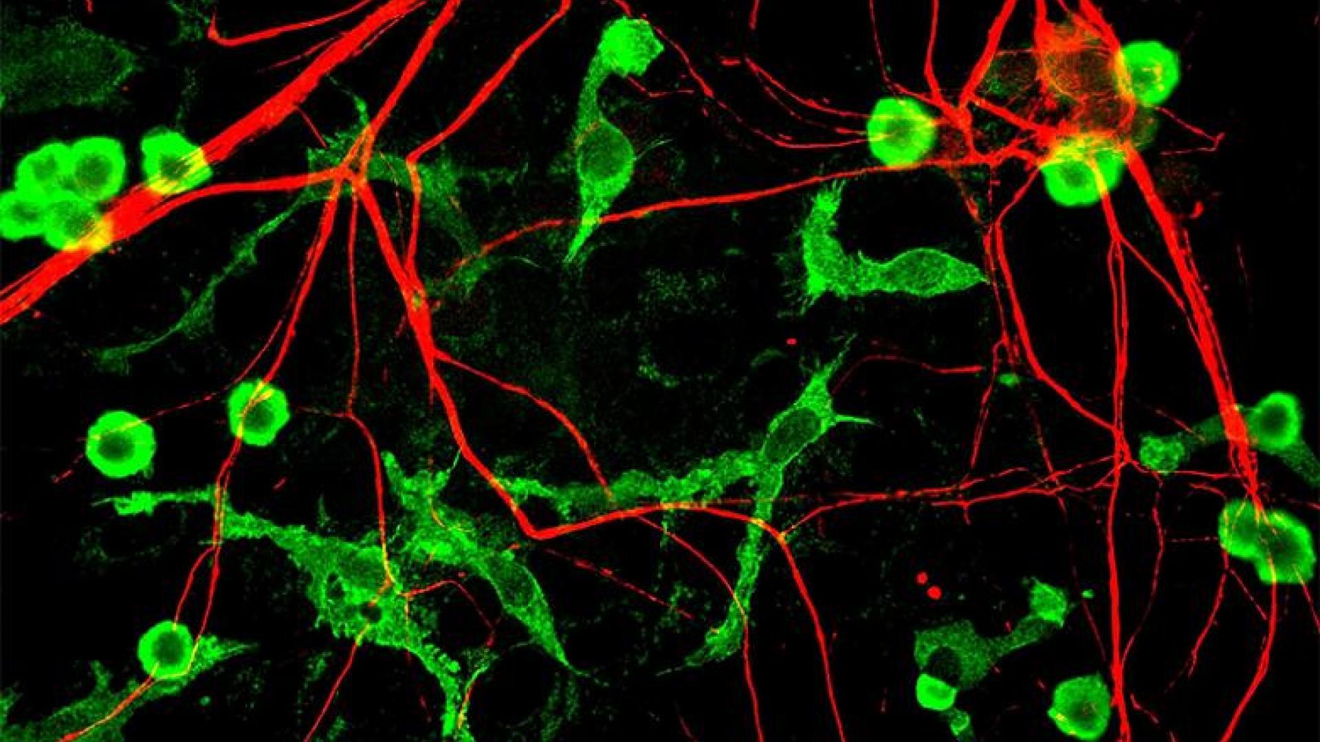 Microfotografía de microglía y neuronas.