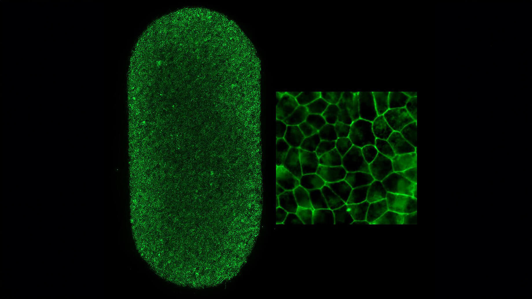 Full-RPE-patch cells and patch RPE cells at higher magnification.