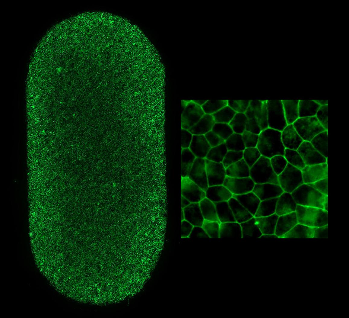 Left shows an image of the full-RPE-patch (2 x 4 mm). Each dot is an RPE cell with the borders stained green. Each patch contains approximately 75,000 RPE cells. Right image shows patch RPE cells at higher magnification.