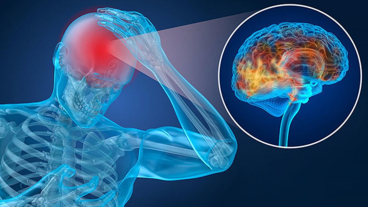 A 3D rendered illustration of a person holding their head in pain, highlighting the skull and brain. The brain is shown with areas of inflammation or injury, suggesting conditions such as traumatic brain injury or concussion.