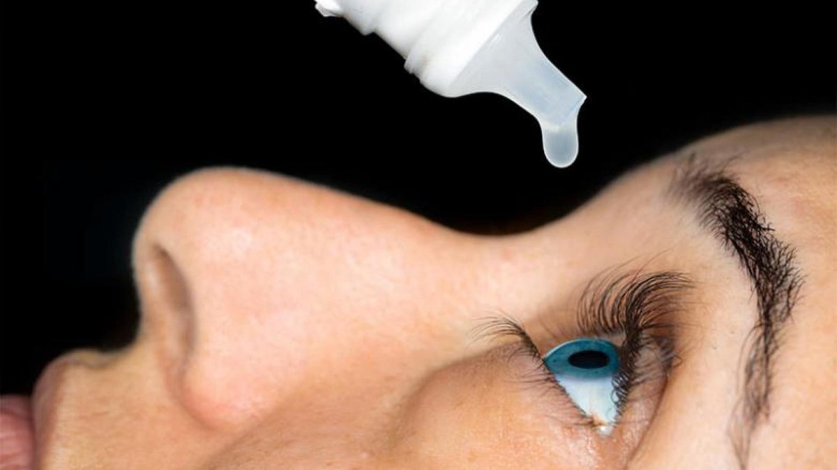 Close-up image of a person applying eye drops into their eye, symbolizing treatment for dry eye or dry macular degeneration.