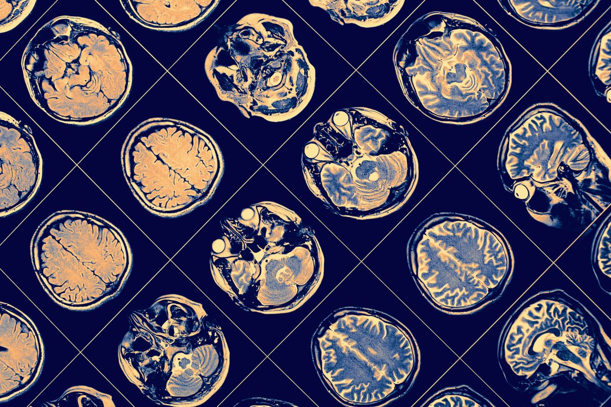 A series of brain scan images displayed in a grid, showing different cross-sectional views of the brain. The scans feature detailed visuals of various brain regions, highlighting structures in shades of orange and blue on a dark background.