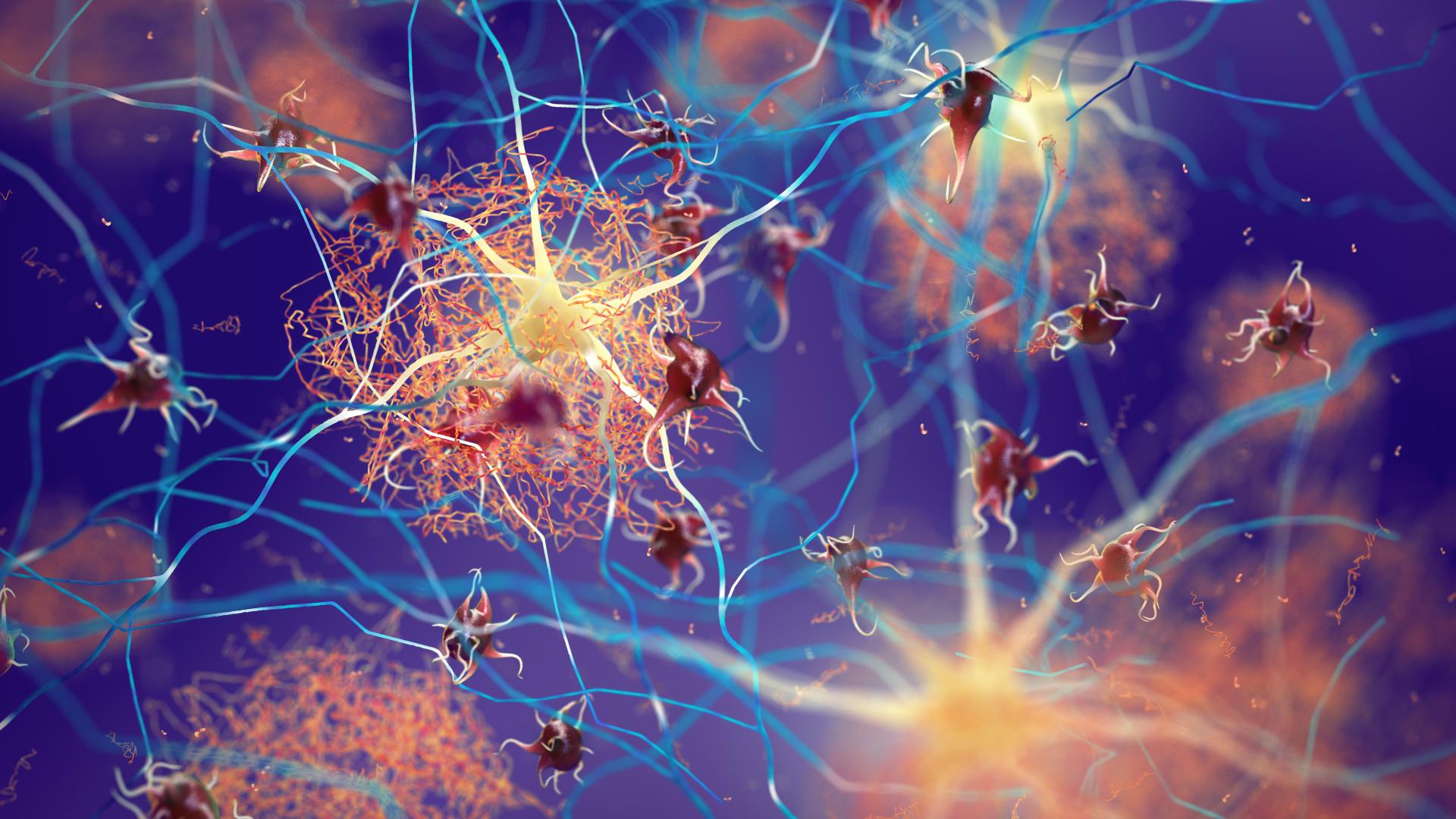 The apolipoprotein E3 mutation, once thought to be “neutral” for Alzheimer’s risk, has a rare version that helps prevent amyloid-beta plaques from forming between neurons (illustrated above).