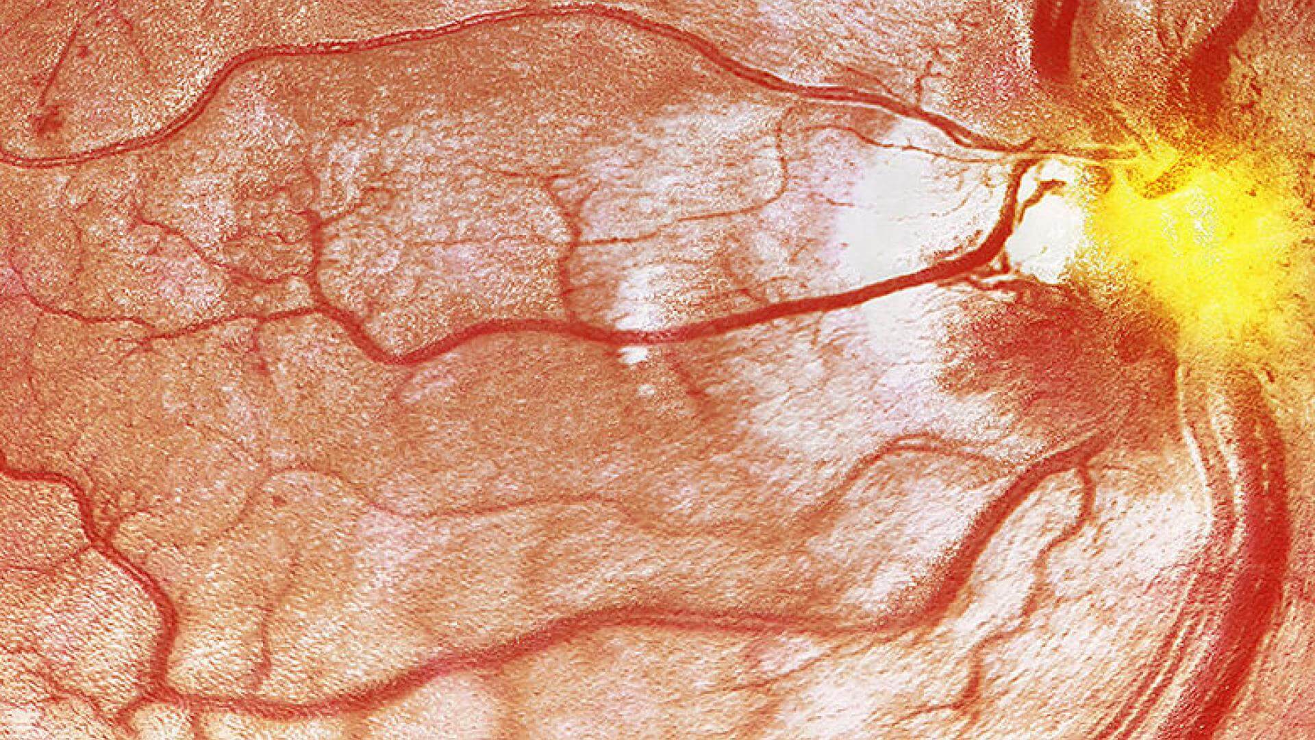 Retina scan showing blood vessel details.