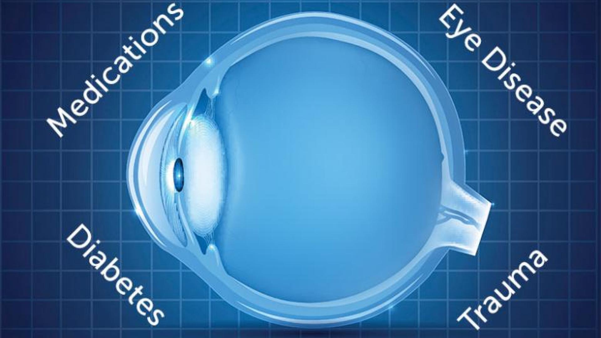 a side cross-section of an eye surrounded by the words medications, eye disease, diabetes, and trauma