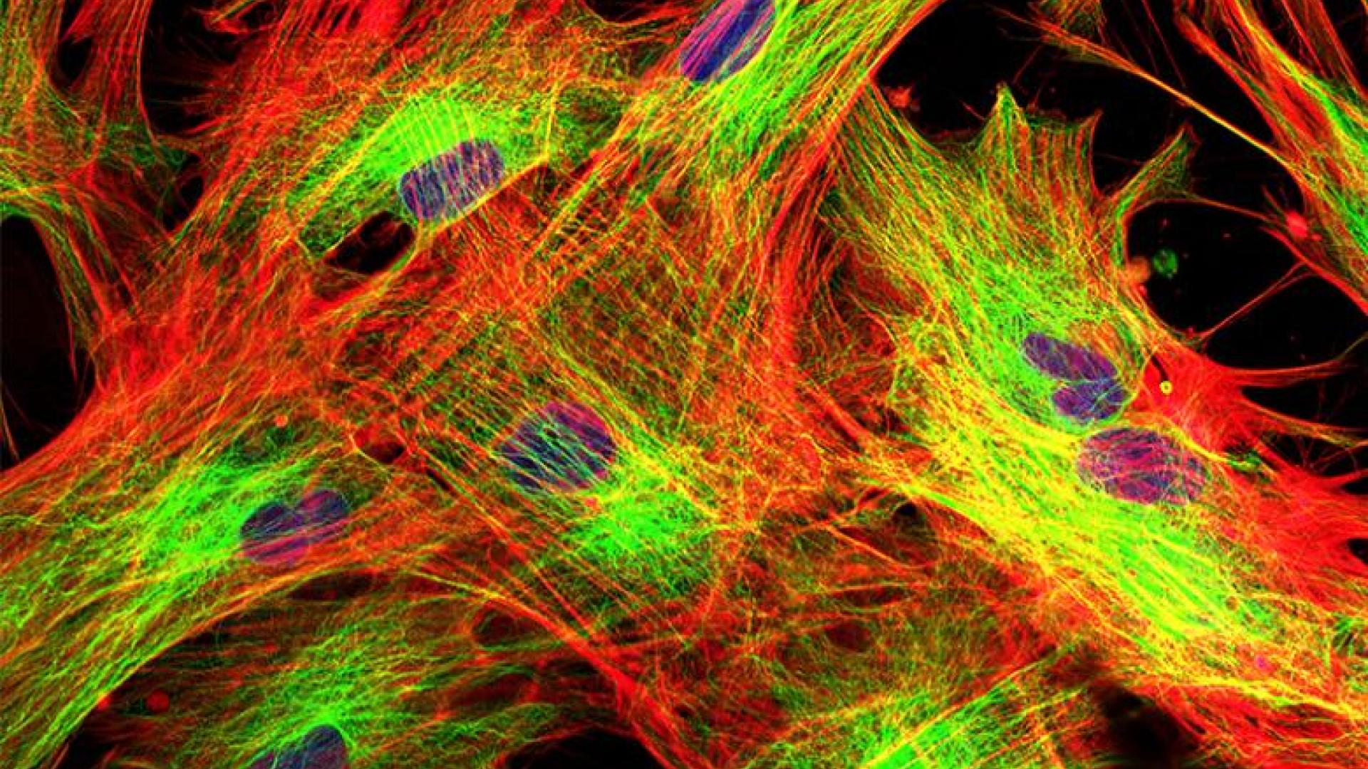 Fibroblasts (skin cells) labeled with fluorescent dyes