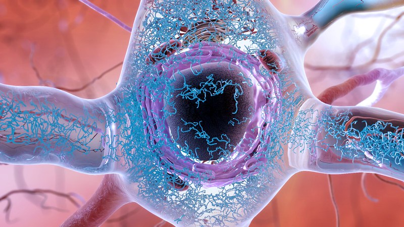 Digital rendering of tau protein buildup inside a cell.