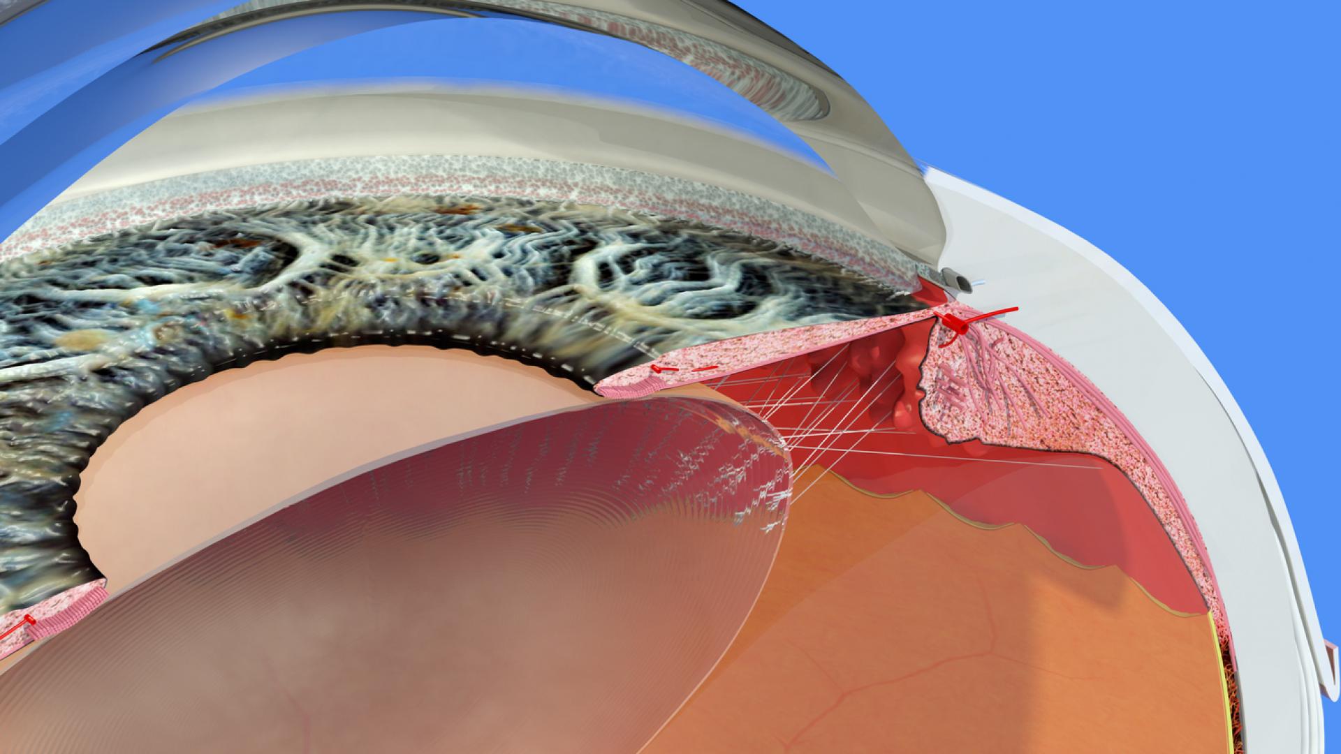 An illustration of the trabecular meshwork.