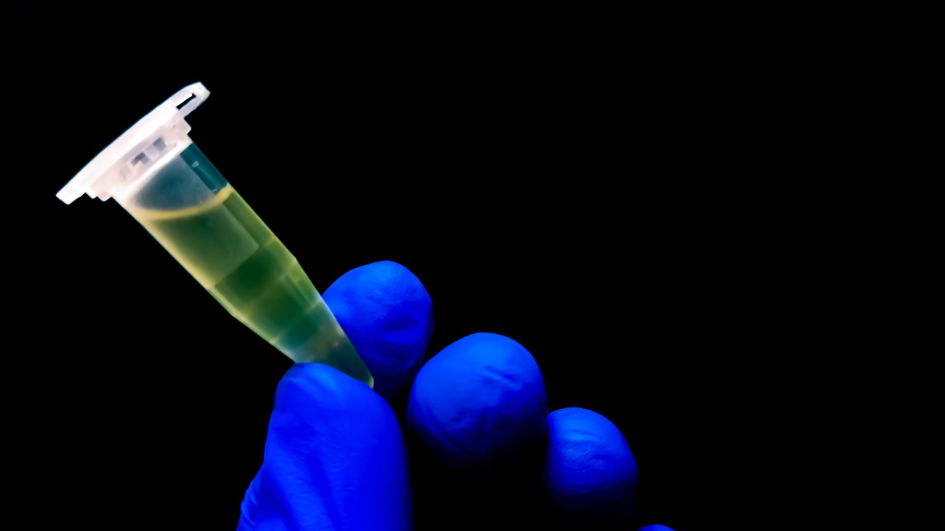 Close-up of a vial of yellowish fluid being held against a black background.