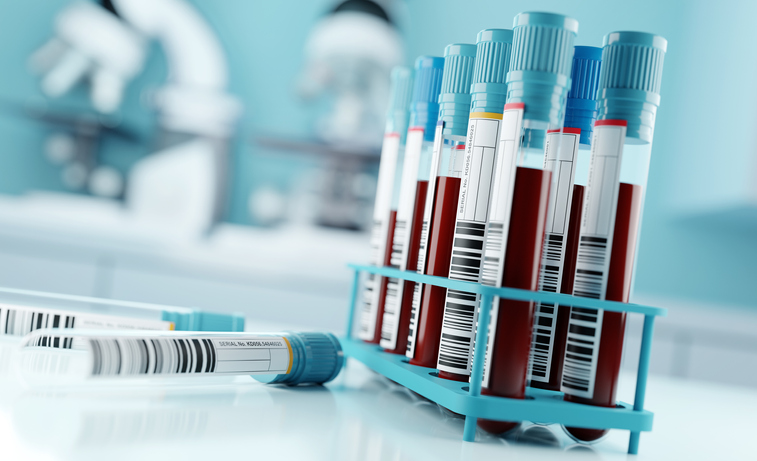 Vials of blood samples on table.