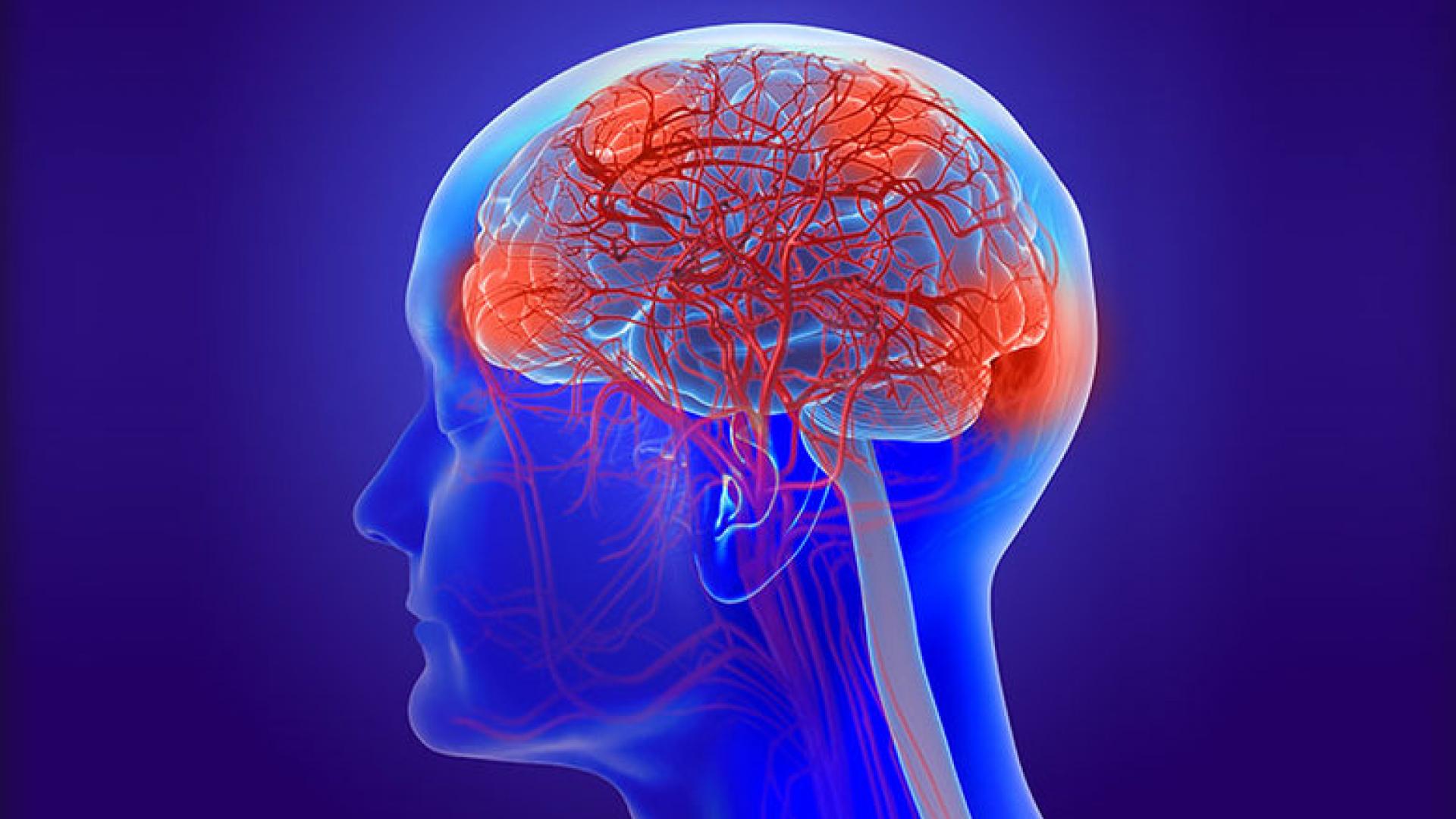 A medical illustration showing the blood vessels of the brain.