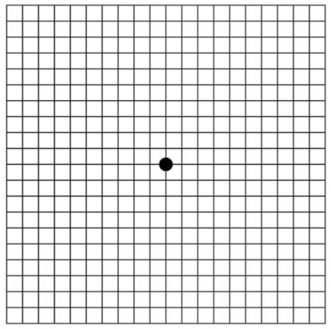 Grid with black dot in the middle to help test for macular degeneration at home.