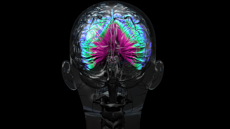 Colorful brain MRI scan.