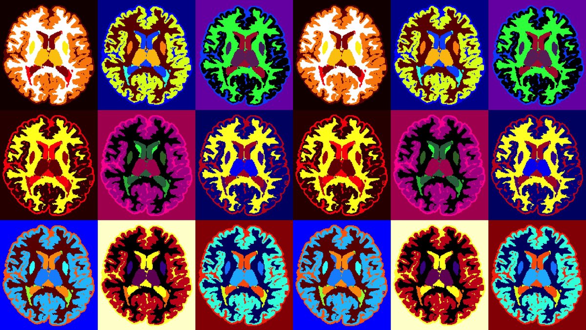 A collage of colorful brain scans.